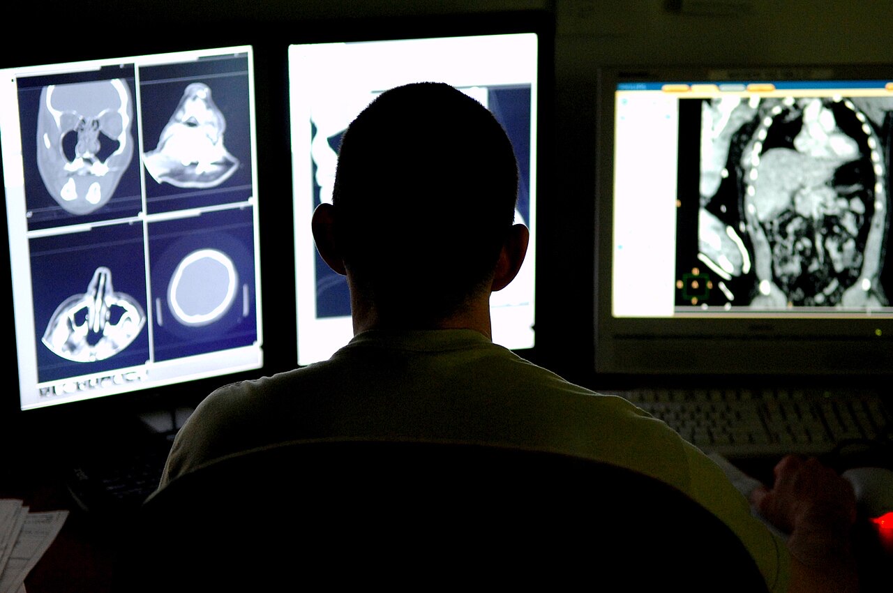 Radiologist reviewing CT images on screens